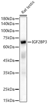 IGF2BP3 Rabbit polyclonal antibody