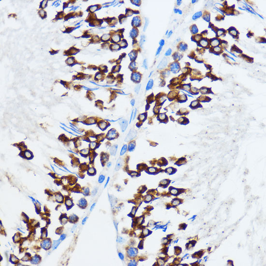 IGF2BP3 Rabbit polyclonal antibody