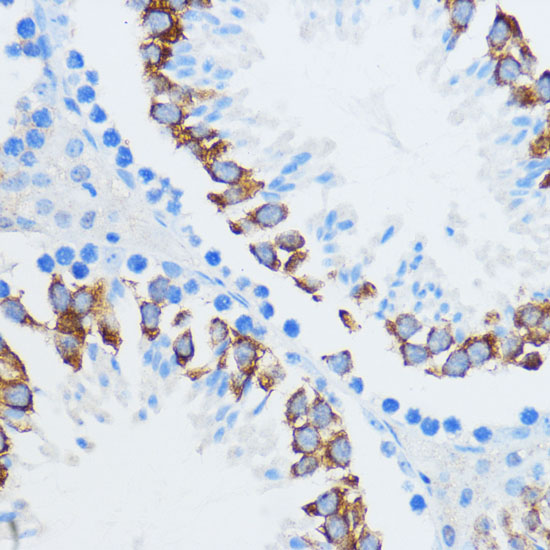 IGF2BP3 Rabbit polyclonal antibody