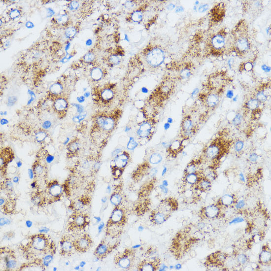 IGF2BP3 Rabbit polyclonal antibody