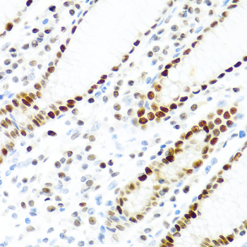 KHDRBS2 Rabbit polyclonal antibody