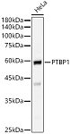 Western blot - PTBP1 Rabbit pAb (A6107)