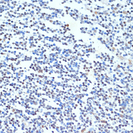 PTBP1 Rabbit polyclonal antibody