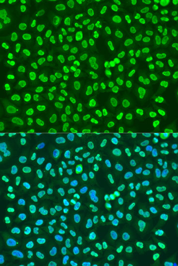 PTBP1 Rabbit polyclonal antibody