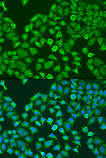 Pumilio 1 Rabbit polyclonal antibody