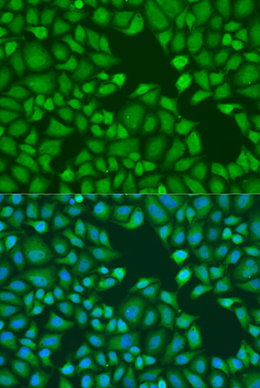 TNRC6A Rabbit polyclonal antibody