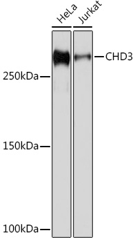 CHD3 Rabbit monoclonal antibody