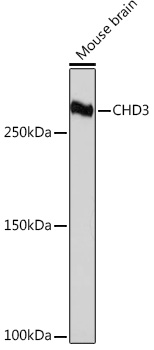 CHD3 Rabbit monoclonal antibody