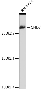 CHD3 Rabbit monoclonal antibody