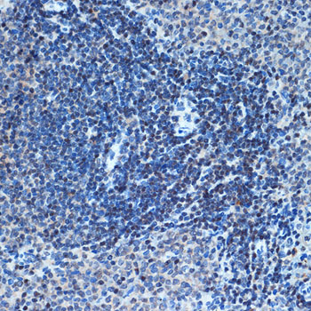CHD3 Rabbit monoclonal antibody
