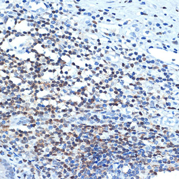 CHD3 Rabbit monoclonal antibody