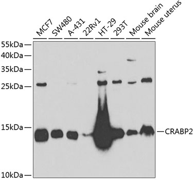 CRABP2 Rabbit polyclonal antibody