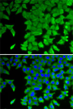 CRABP2 Rabbit polyclonal antibody