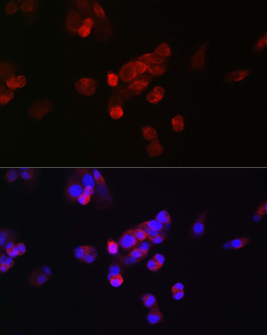 FGF23 Rabbit polyclonal antibody