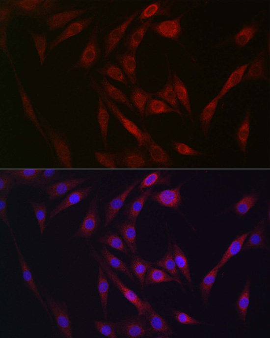 FGF23 Rabbit polyclonal antibody
