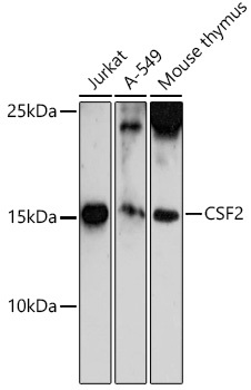 CSF2 Rabbit polyclonal antibody