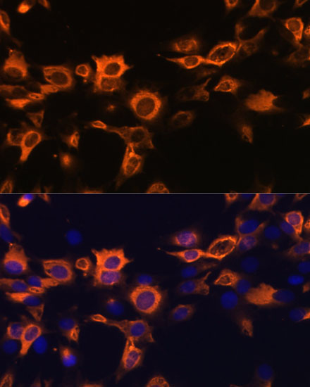 CSF2 Rabbit polyclonal antibody