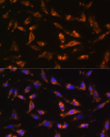 CSF2 Rabbit polyclonal antibody