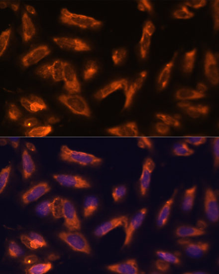 CSF2 Rabbit polyclonal antibody