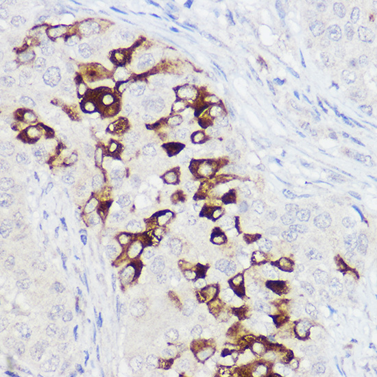 PIGR Rabbit polyclonal antibody