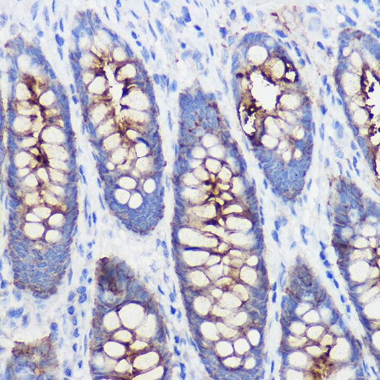 PIGR Rabbit polyclonal antibody