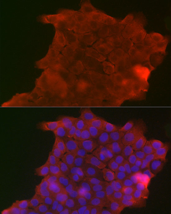 PIGR Rabbit polyclonal antibody