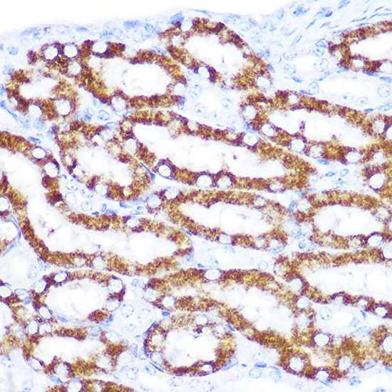 TNFRSF10D Rabbit polyclonal antibody