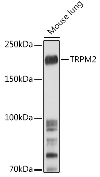 TRPM2 Rabbit polyclonal antibody
