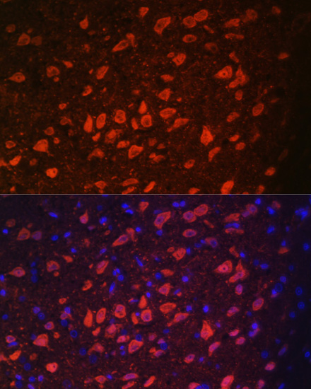 TRPM2 Rabbit polyclonal antibody