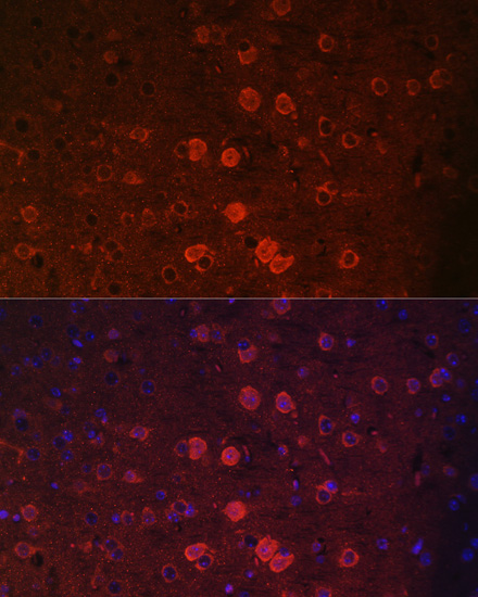 TRPM2 Rabbit polyclonal antibody
