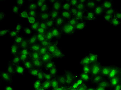 C11orf30 Rabbit polyclonal antibody