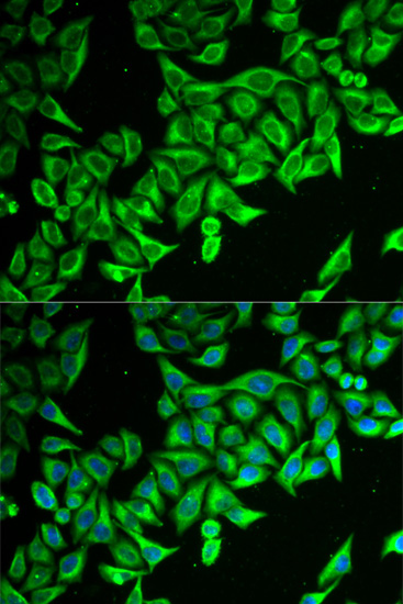 DAP Rabbit polyclonal antibody