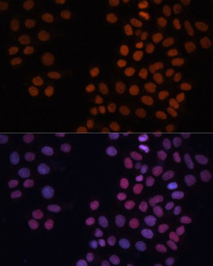 HMGN1 Rabbit polyclonal antibody