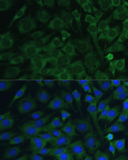 Oncostatin M Rabbit polyclonal antibody