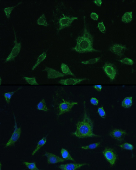 Oncostatin M Rabbit polyclonal antibody