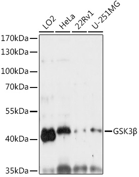 GSK3B Beta Rabbit polyclonal antibody