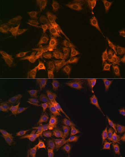 NAP1L1 Rabbit monoclonal antibody