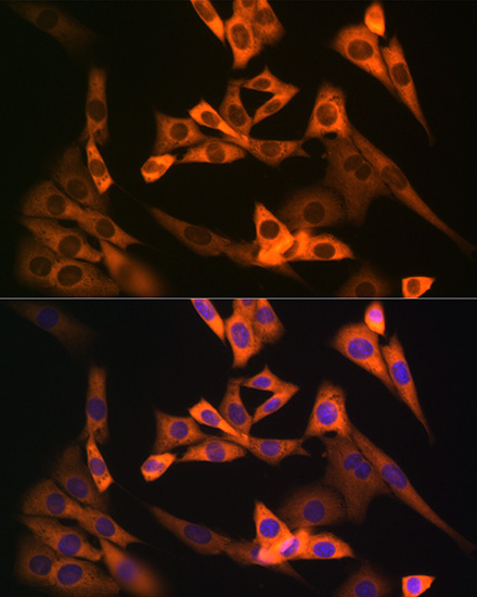 NAP1L1 Rabbit monoclonal antibody