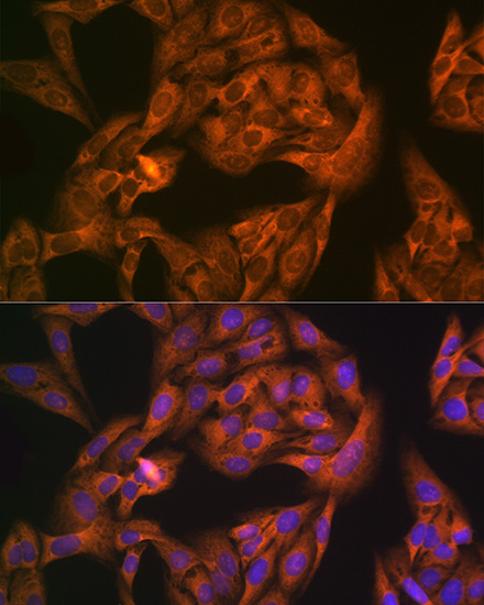 NAP1L1 Rabbit monoclonal antibody