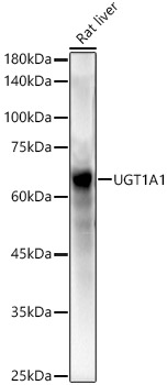 UGT1A1 Rabbit polyclonal antibody