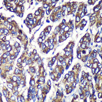 UGT1A1 Rabbit polyclonal antibody