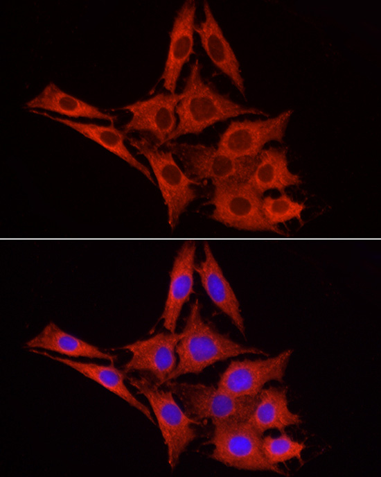 UGT1A1 Rabbit polyclonal antibody