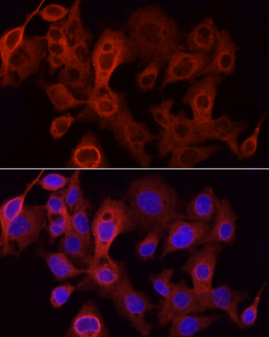 UGT1A1 Rabbit polyclonal antibody