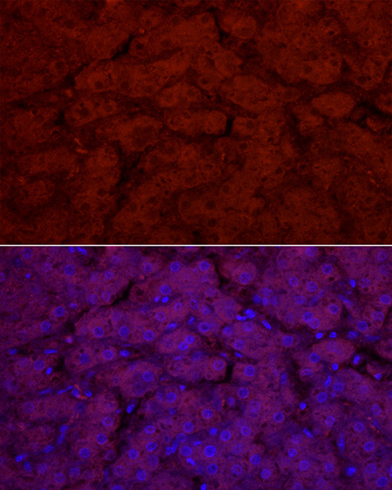 UGT1A1 Rabbit polyclonal antibody