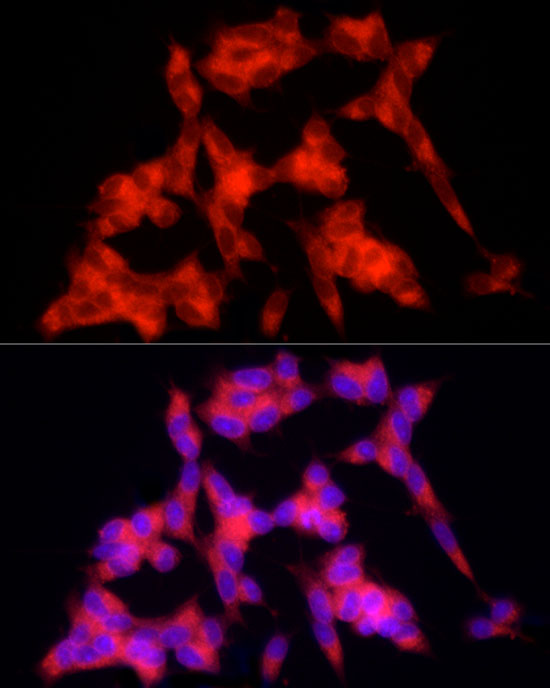 PSD95 Rabbit polyclonal antibody