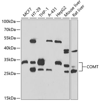 COMT Rabbit polyclonal antibody