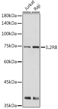 IL2RB Rabbit polyclonal antibody