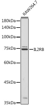IL2RB Rabbit polyclonal antibody