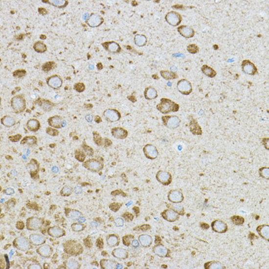 IRAK4 Rabbit polyclonal antibody