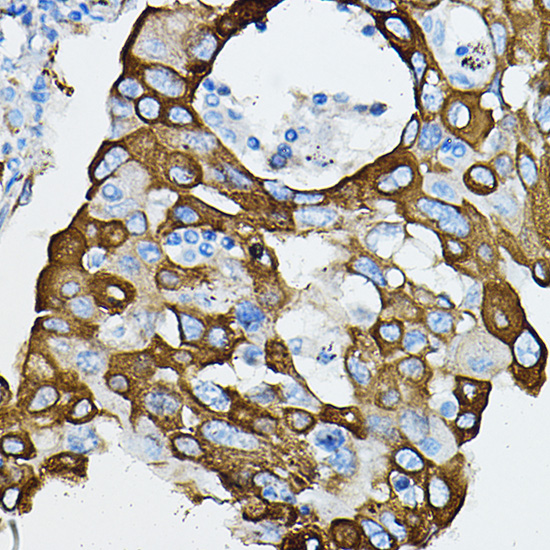 IRAK4 Rabbit polyclonal antibody